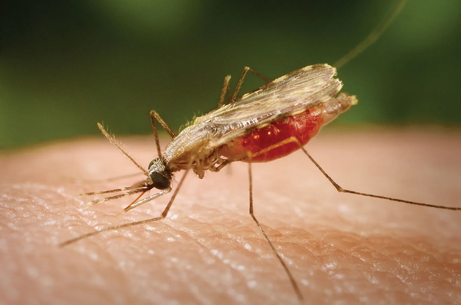 Malaria Prevention, Awareness & Treatment: Expert Guide by Lopmudra Hospital – General Medicine