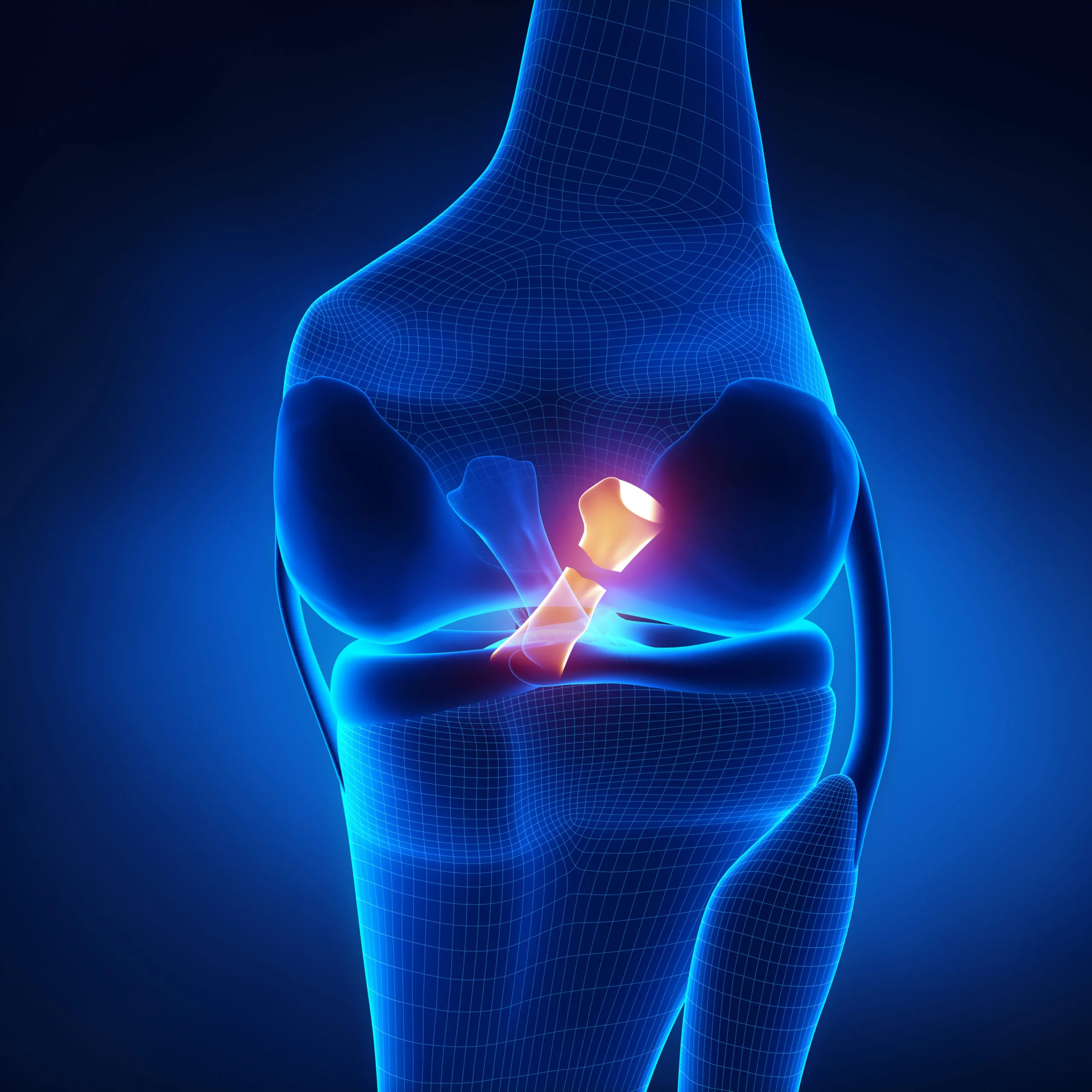 ACL Treatment: Options, Process, Costs & Benefits at Lopmudra Hospital