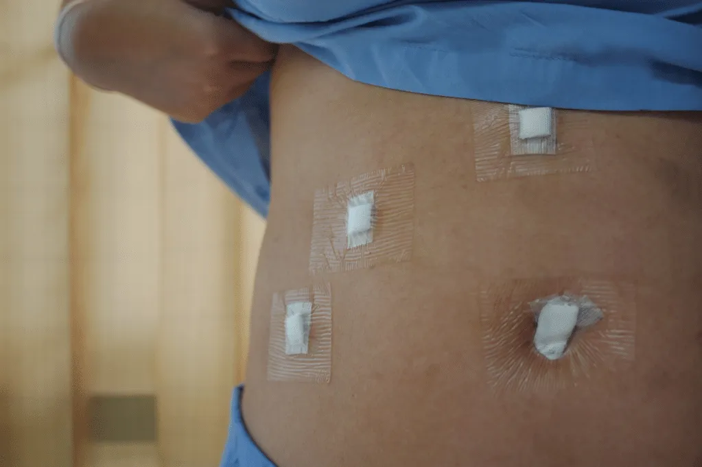 Laparoscopic Gallstone Surgery Benefits: Faster Recovery & Less Pain — Lopmudra
