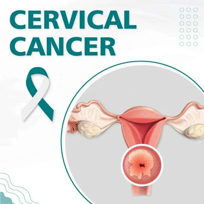 Cervical Cancer Screening & Vaccination in Pune: Book Your Pap Smear at Lopmudra Meera Hospital