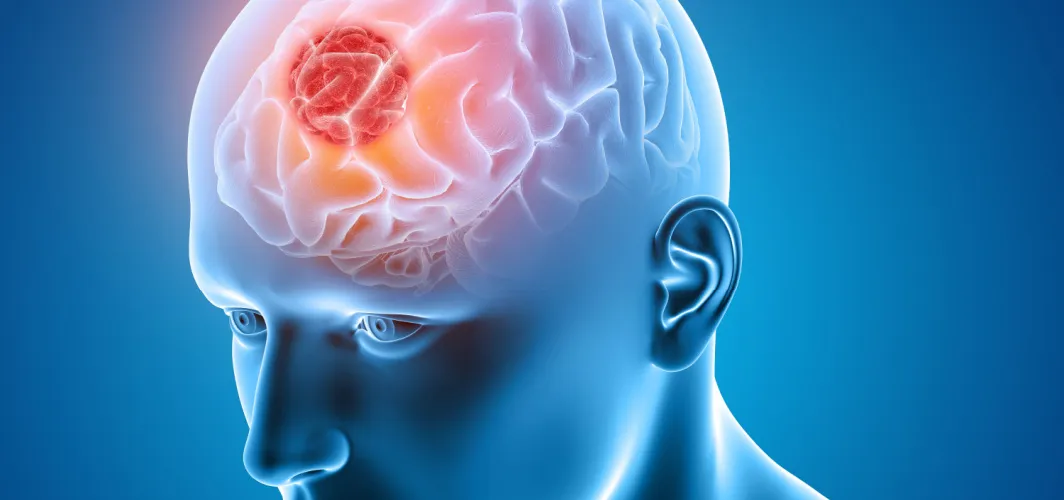 Early Brain Tumour Signs You Should Never Ignore | Dr Vishal Bhasme | Lopmudra Meera Hospital, Pune